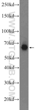 BRIT1 Antibody in Western Blot (WB)