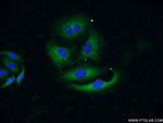 AGR3 Antibody in Immunocytochemistry (ICC/IF)