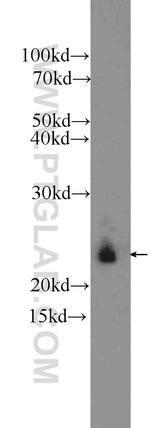 AGR3 Antibody in Western Blot (WB)