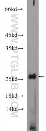 AGR3 Antibody in Western Blot (WB)