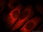 PPP1R2P9 Antibody in Immunocytochemistry (ICC/IF)