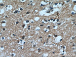 PPP1R2P9 Antibody in Immunohistochemistry (Paraffin) (IHC (P))