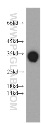 PPP1R2P9 Antibody in Western Blot (WB)