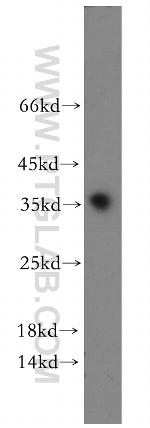 PPP1R2P9 Antibody in Western Blot (WB)