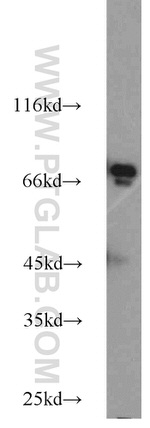 DNAJC2/MPP11 Antibody in Western Blot (WB)