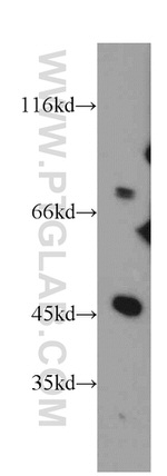 DNAJC2/MPP11 Antibody in Western Blot (WB)