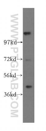 TIPIN Antibody in Western Blot (WB)