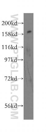 FANCA Antibody in Western Blot (WB)