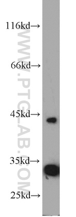 P2RY12 Antibody in Western Blot (WB)