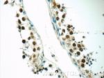 EXOSC8 Antibody in Immunohistochemistry (Paraffin) (IHC (P))