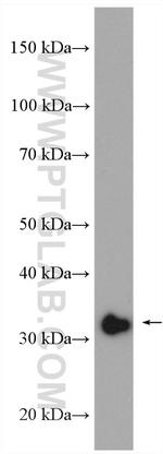 EXOSC8 Antibody in Western Blot (WB)