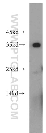 EXOSC8 Antibody in Western Blot (WB)