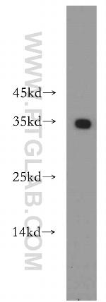 EXOSC8 Antibody in Western Blot (WB)