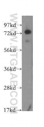 IL17RE Antibody in Western Blot (WB)