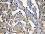 PRTFDC1 Antibody in Immunohistochemistry (Paraffin) (IHC (P))