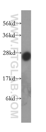 PRTFDC1 Antibody in Western Blot (WB)