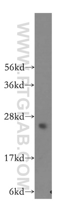 PRTFDC1 Antibody in Western Blot (WB)