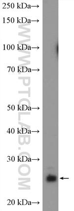 PRTFDC1 Antibody in Western Blot (WB)