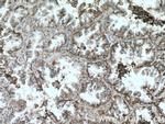 CD147 Antibody in Immunohistochemistry (Paraffin) (IHC (P))