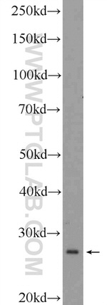 RPS3 Antibody in Western Blot (WB)