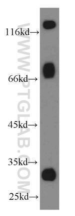 Galc Antibody in Western Blot (WB)