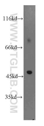 Galc Antibody in Western Blot (WB)