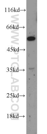 Angiotensinogen Antibody in Western Blot (WB)