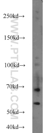 Angiotensinogen Antibody in Western Blot (WB)