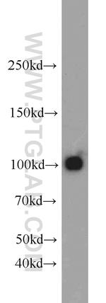 Glutamate receptor 2 Antibody in Western Blot (WB)
