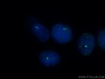 MLK3 Antibody in Immunocytochemistry (ICC/IF)