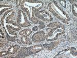 MLK3 Antibody in Immunohistochemistry (Paraffin) (IHC (P))