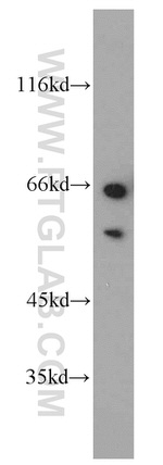 MLK3 Antibody in Western Blot (WB)