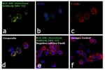 HLA-ABC Antibody