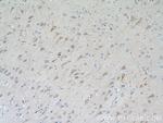 TrkC Antibody in Immunohistochemistry (Paraffin) (IHC (P))