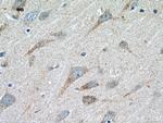 TrkC Antibody in Immunohistochemistry (Paraffin) (IHC (P))