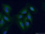 TrkC Antibody in Immunocytochemistry (ICC/IF)