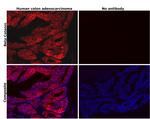 beta Catenin Antibody in Immunohistochemistry (Paraffin) (IHC (P))