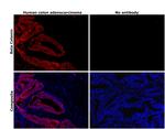 beta Catenin Antibody in Immunohistochemistry (Paraffin) (IHC (P))