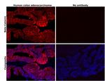 beta Catenin Antibody in Immunohistochemistry (Paraffin) (IHC (P))