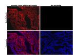 beta Catenin Antibody in Immunohistochemistry (Paraffin) (IHC (P))