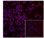 Rat IgG2a kappa Isotype Control in Immunocytochemistry (ICC/IF)