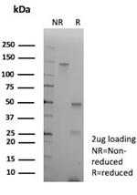 Alpha-1-Antichymotrypsin (SERPINA3) (Histiocytoma Marker) Antibody in SDS-PAGE (SDS-PAGE)