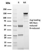 Alpha-1-Antichymotrypsin (SERPINA3) (Histiocytoma Marker) Antibody in SDS-PAGE (SDS-PAGE)