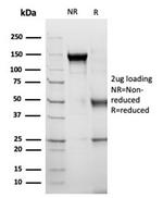 Alpha-1-Antichymotrypsin (SERPINA3) (Histiocytoma Marker) Antibody in Immunoelectrophoresis (IE)