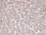 Alpha-1-Antichymotrypsin (SERPINA3) (Histiocytoma Marker) Antibody in Immunohistochemistry (Paraffin) (IHC (P))