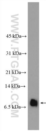 RANTES Antibody in Western Blot (WB)