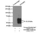 EFEMP2 Antibody in Immunoprecipitation (IP)