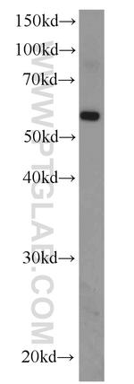 EFEMP2 Antibody in Western Blot (WB)