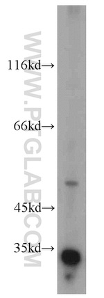 EFEMP2 Antibody in Western Blot (WB)