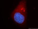 VPS45 Antibody in Immunocytochemistry (ICC/IF)